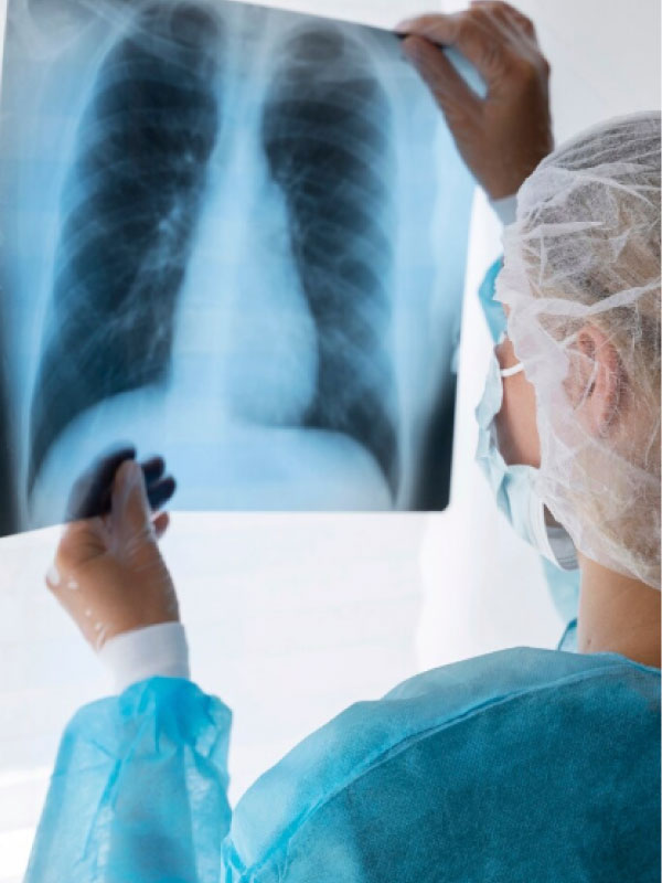 radiografia