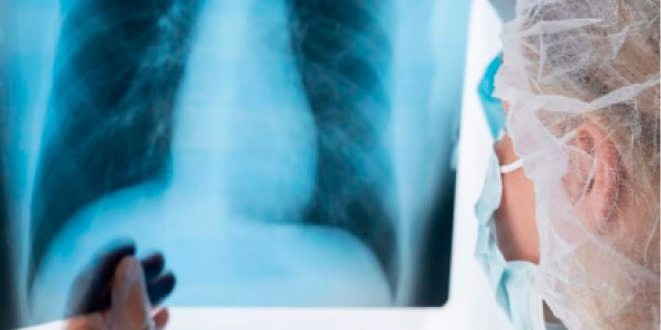 radiografia_m